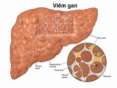 Hepatic Là Gì